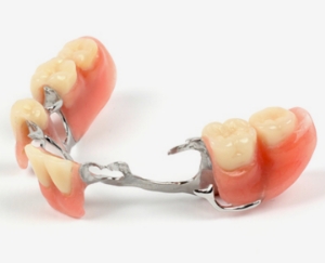 Treatment Option for missing multiple teeth removable partial denture