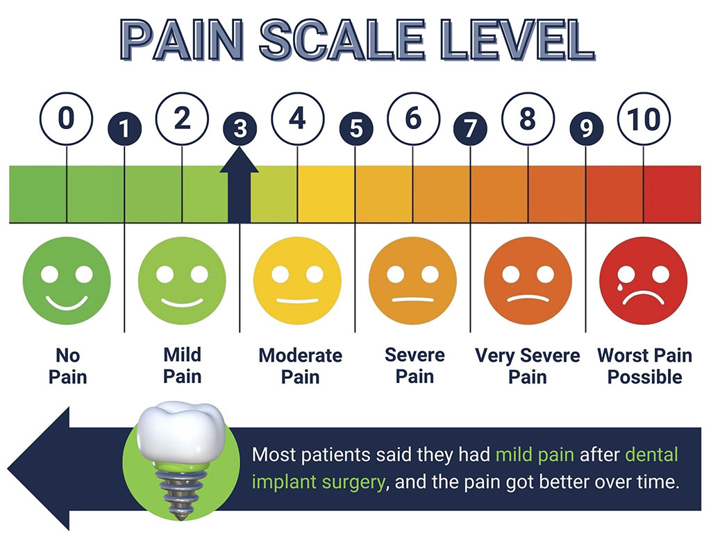 Dental implants pain scale level