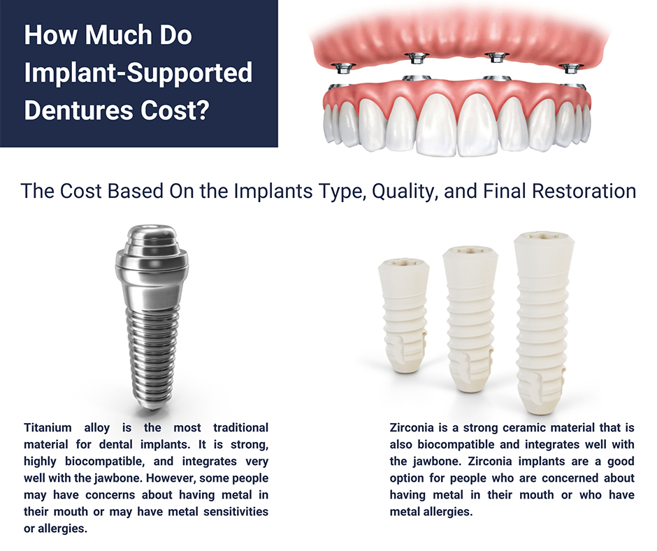 Implant-Supported Dentures Cost