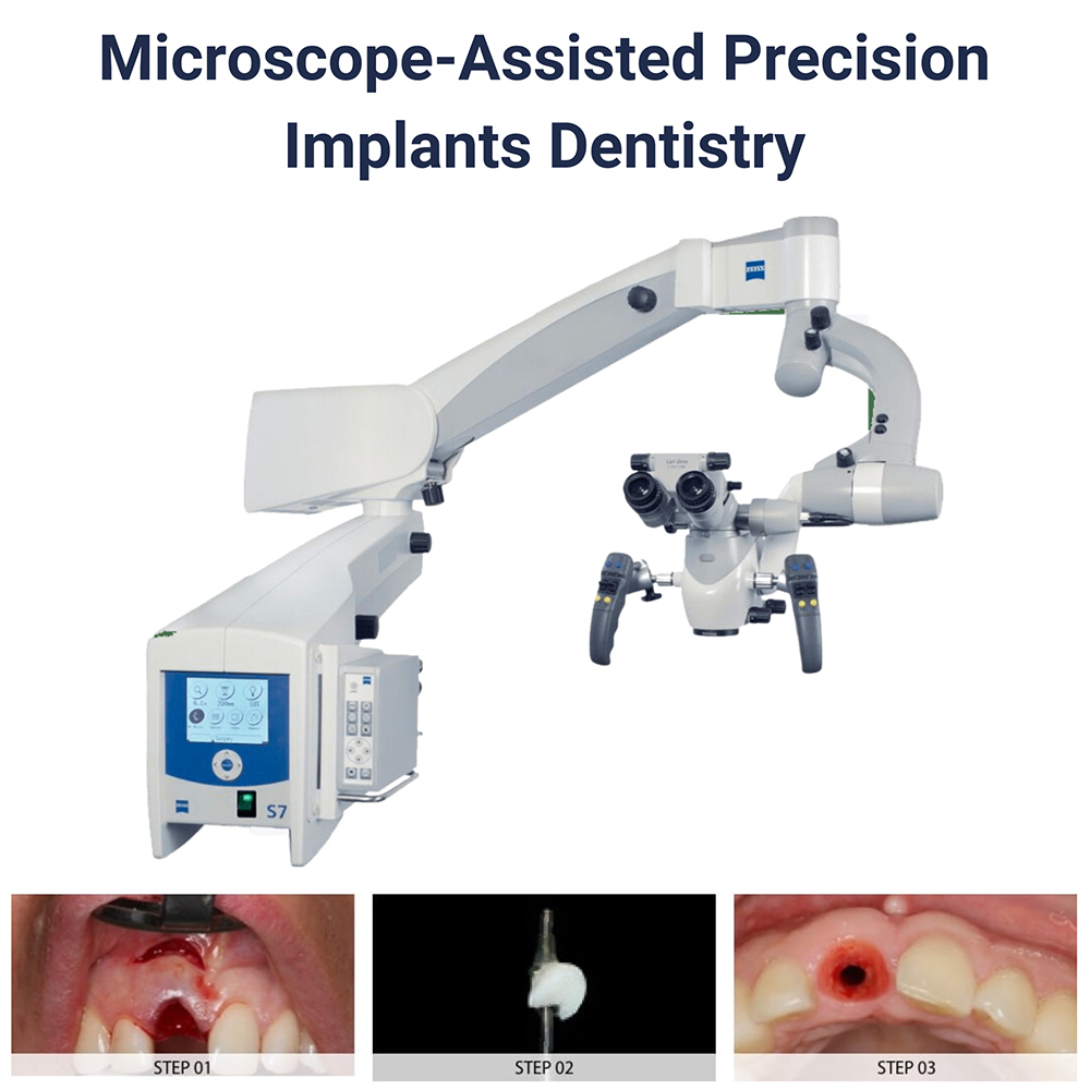 Microscope assisted precision implants dentistry