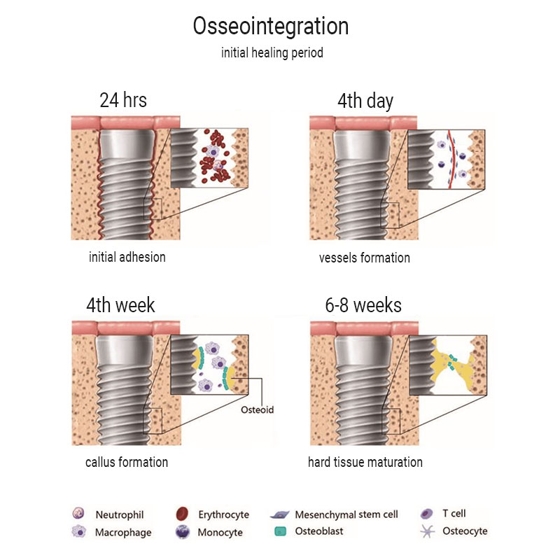 osseointegration phases